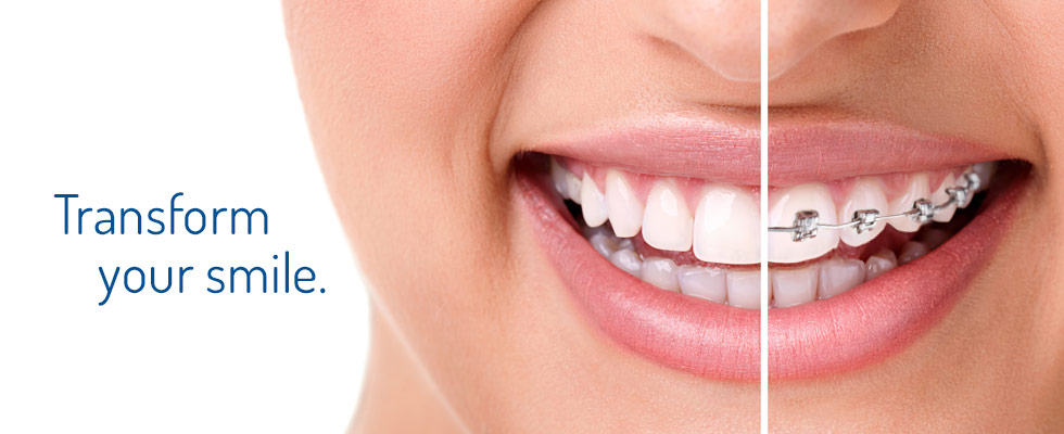 Smile Hub Superspeciality Dental & Maxillofacial Clinic