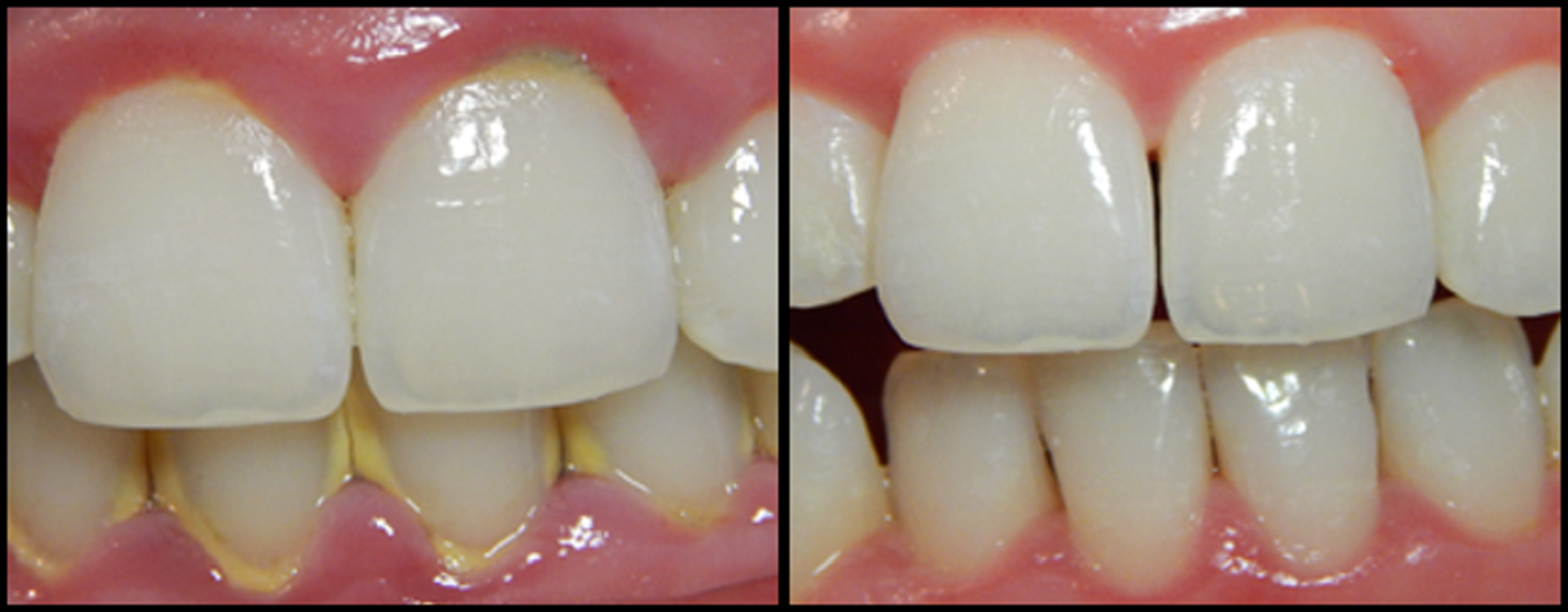 Best Dental clinic in gomti nagar extension