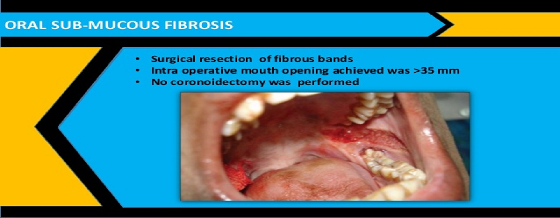 Best dental treatment in vibhuti khand lko