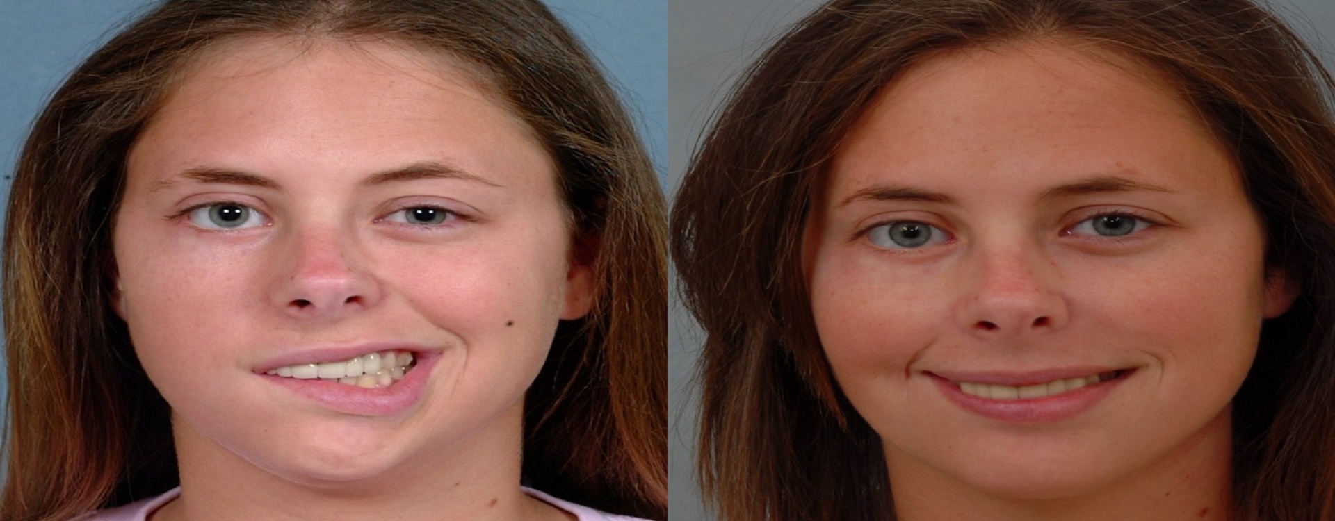 Best Dental clinic in gomti nagar extension